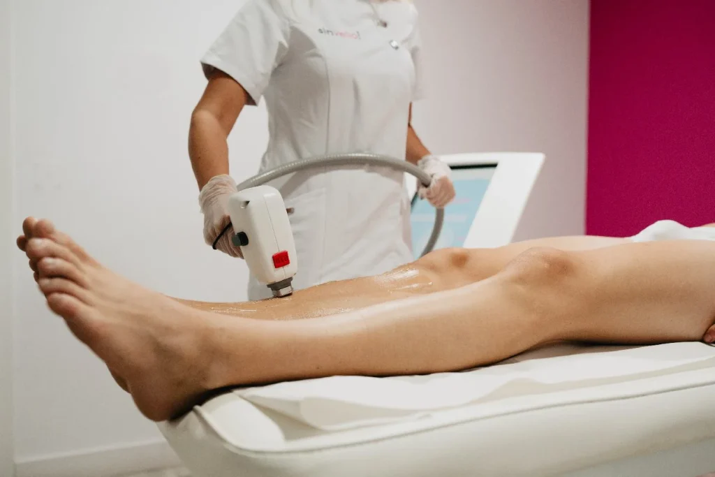 Depilação a Laser no Verão: Pode Fazer?